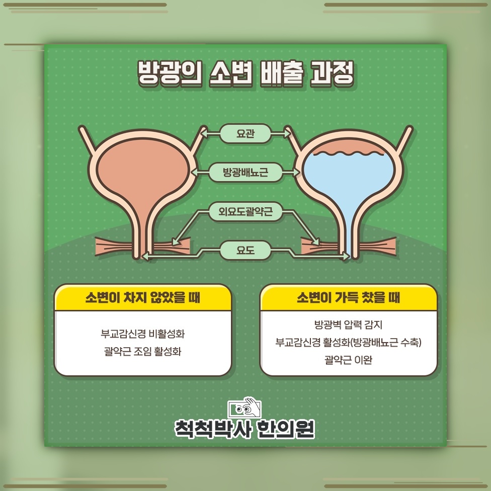 일상 속 불편을 줄이는 요실금 관리의 방향